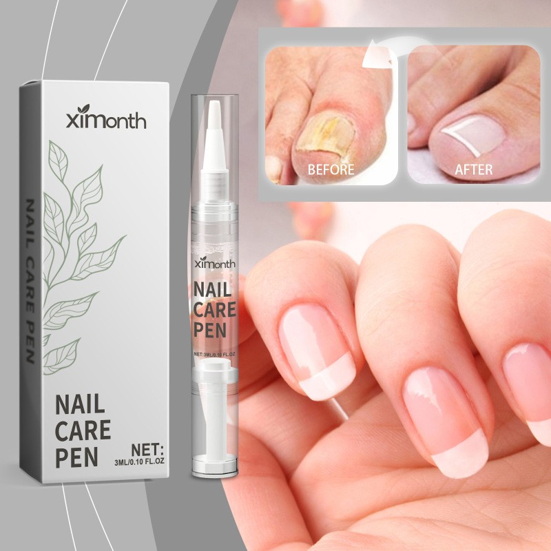 Nail Care Pen - Gentle Repair for Damaged Nails